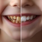 kid before after teeth