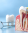 What Is a Root Canal? Treatment, Procedure, Signs & Recovery