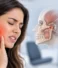 What Is TMJ? Symptoms, Causes & Treatment